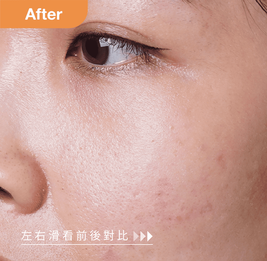 使用後